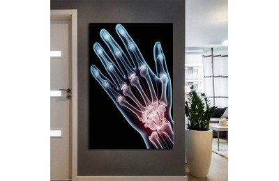 Fizik Tedavi ve Rehabilitasyon Temalı Kanvas Tablo ftv12