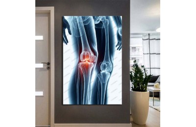 Fizik Tedavi ve Rehabilitasyon Temalı Kanvas Tablo ftv14