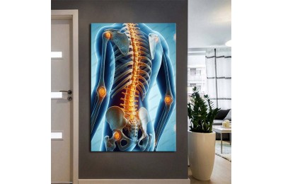 Fizik Tedavi ve Rehabilitasyon Temalı Kanvas Tablo ftv16