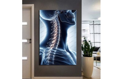 Fizik Tedavi ve Rehabilitasyon Temalı Kanvas Tablo ftv17