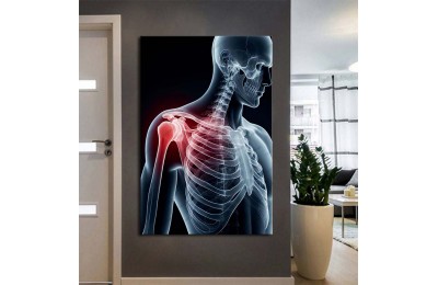 Fizik Tedavi ve Rehabilitasyon Temalı Kanvas Tablo ftv2