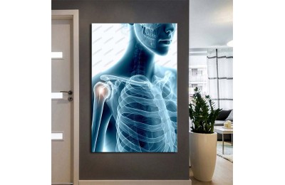 Fizik Tedavi ve Rehabilitasyon Temalı Kanvas Tablo ftv24