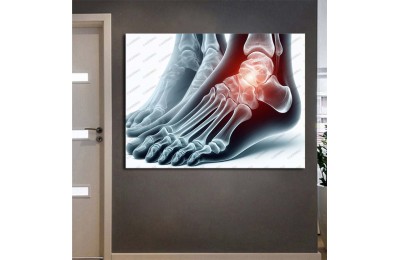 Fizik Tedavi ve Rehabilitasyon Temalı Kanvas Tablo ftv25