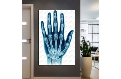 Fizik Tedavi ve Rehabilitasyon Temalı Kanvas Tablo ftv31