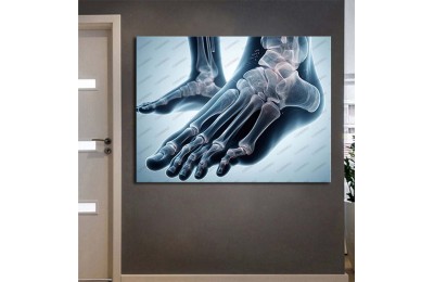 Fizik Tedavi ve Rehabilitasyon Temalı Kanvas Tablo ftv32