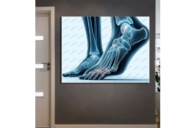 Fizik Tedavi ve Rehabilitasyon Temalı Kanvas Tablo ftv33