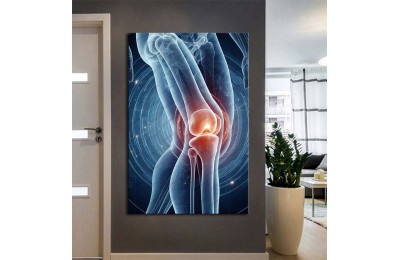 Fizik Tedavi ve Rehabilitasyon Temalı Kanvas Tablo ftv34