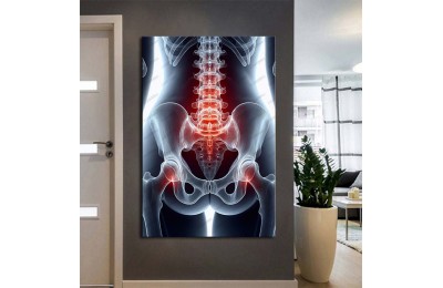 Fizik Tedavi ve Rehabilitasyon Temalı Kanvas Tablo ftv35