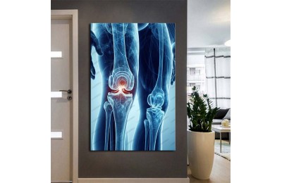 Fizik Tedavi ve Rehabilitasyon Temalı Kanvas Tablo ftv36