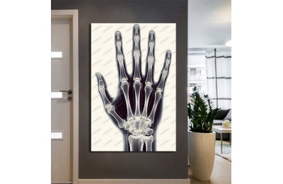 Fizik Tedavi ve Rehabilitasyon Temalı Kanvas Tablo ftv4