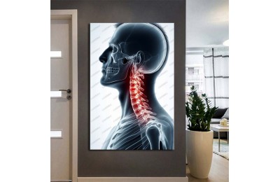 Fizik Tedavi ve Rehabilitasyon Temalı Kanvas Tablo ftv41