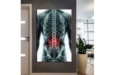 Fizik Tedavi ve Rehabilitasyon Temalı Kanvas Tablo ftv6