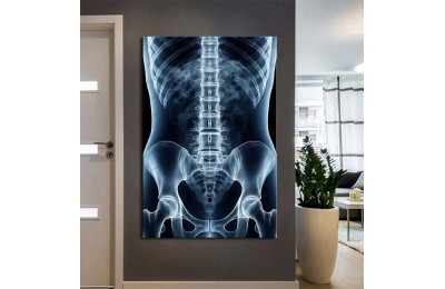 Fizik Tedavi ve Rehabilitasyon Temalı Kanvas Tablo ftv9