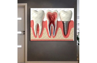dsc633 Ağız ve Diş Polikliniği, Dişçi Tabloları, Diş Hekimi, İmplant Tablo
