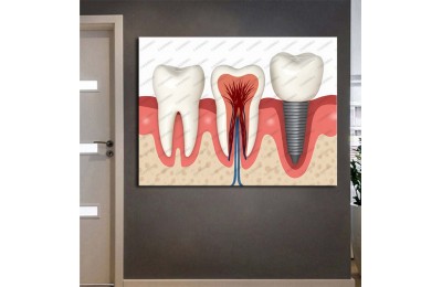 dsc648 Ağız ve Diş Polikliniği, Dişçi Tabloları, Diş Hekimi, İmplant Tablo