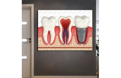dsc651 Ağız ve Diş Polikliniği, Dişçi Tabloları, Diş Hekimi, İmplant Tablo