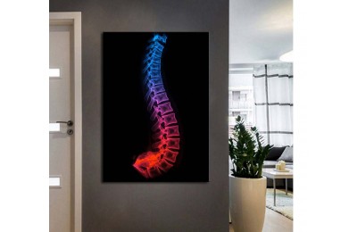 ftv57 Fizik Tedavi ve Rehabilitasyon Temalı Omurga Neon Renkler Tablo