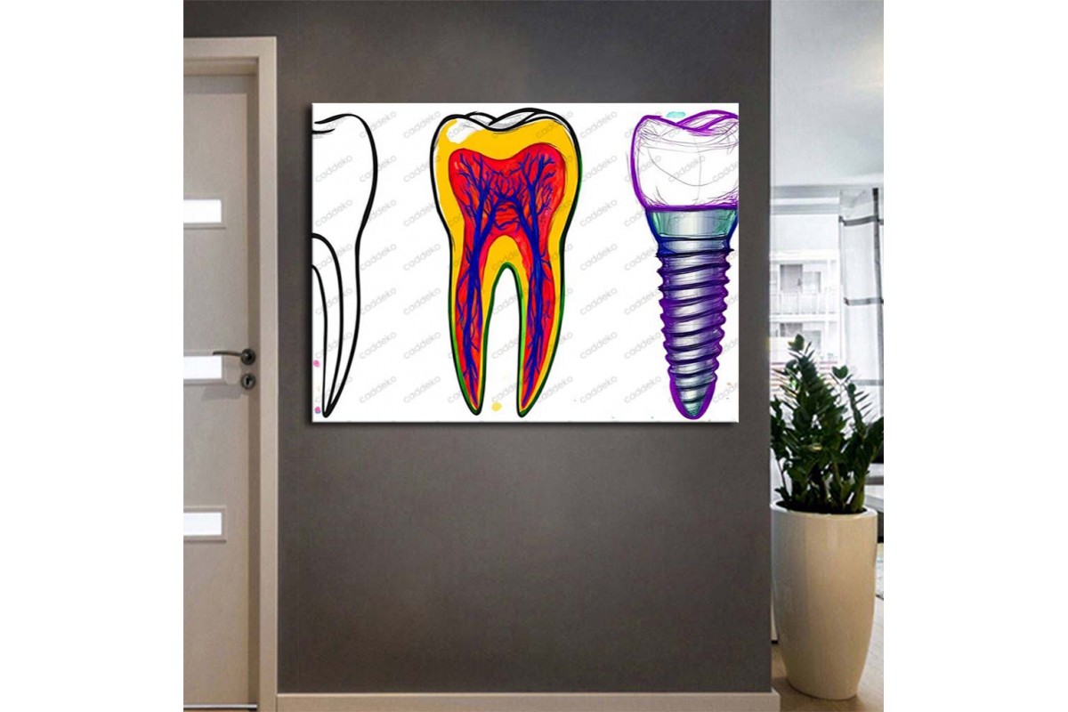 Ağız ve Diş Sağlığı Polikliniği Tabloları Dekoratif Diş, Dekoratif Dişçi, Dişçi Dekorasyonu dsc578