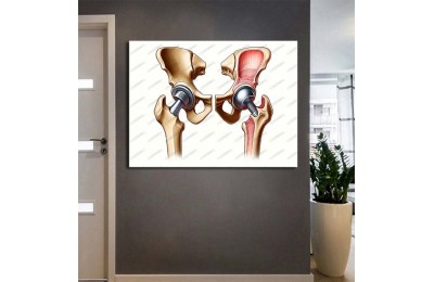 Poliklinik Klinik Hastane Dekorasyonu Medikal Hastane Tabloları hst195