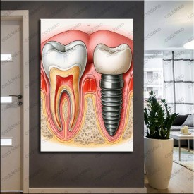 Ağız ve Diş Polikliniği, Dişçi Tabloları Dekoratif Diş, Dekoratif Dişçi, Dişçi Dekorasyonu dsc616