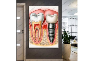 Ağız ve Diş Polikliniği, Dişçi Tabloları Dekoratif Diş, Dekoratif Dişçi, Dişçi Dekorasyonu dsc616