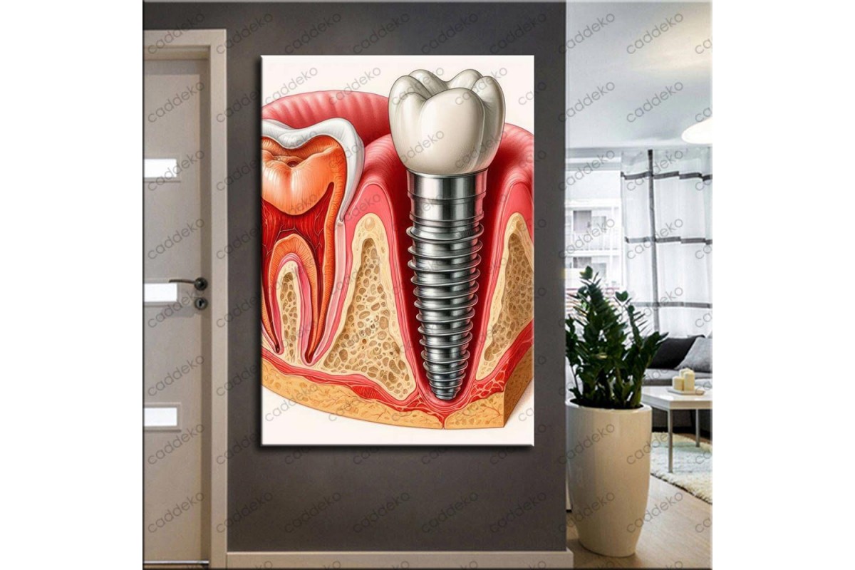 Ağız ve Diş Polikliniği, Dişçi Tabloları Dekoratif Diş, Dekoratif Dişçi, Dişçi Dekorasyonu dsc626