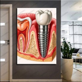 Ağız ve Diş Polikliniği, Dişçi Tabloları Dekoratif Diş, Dekoratif Dişçi, Dişçi Dekorasyonu dsc626