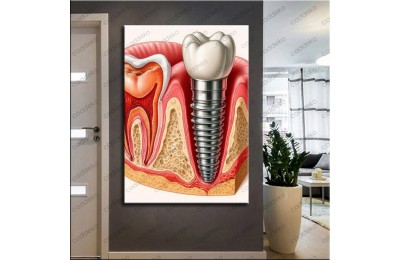 Ağız ve Diş Polikliniği, Dişçi Tabloları Dekoratif Diş, Dekoratif Dişçi, Dişçi Dekorasyonu dsc626