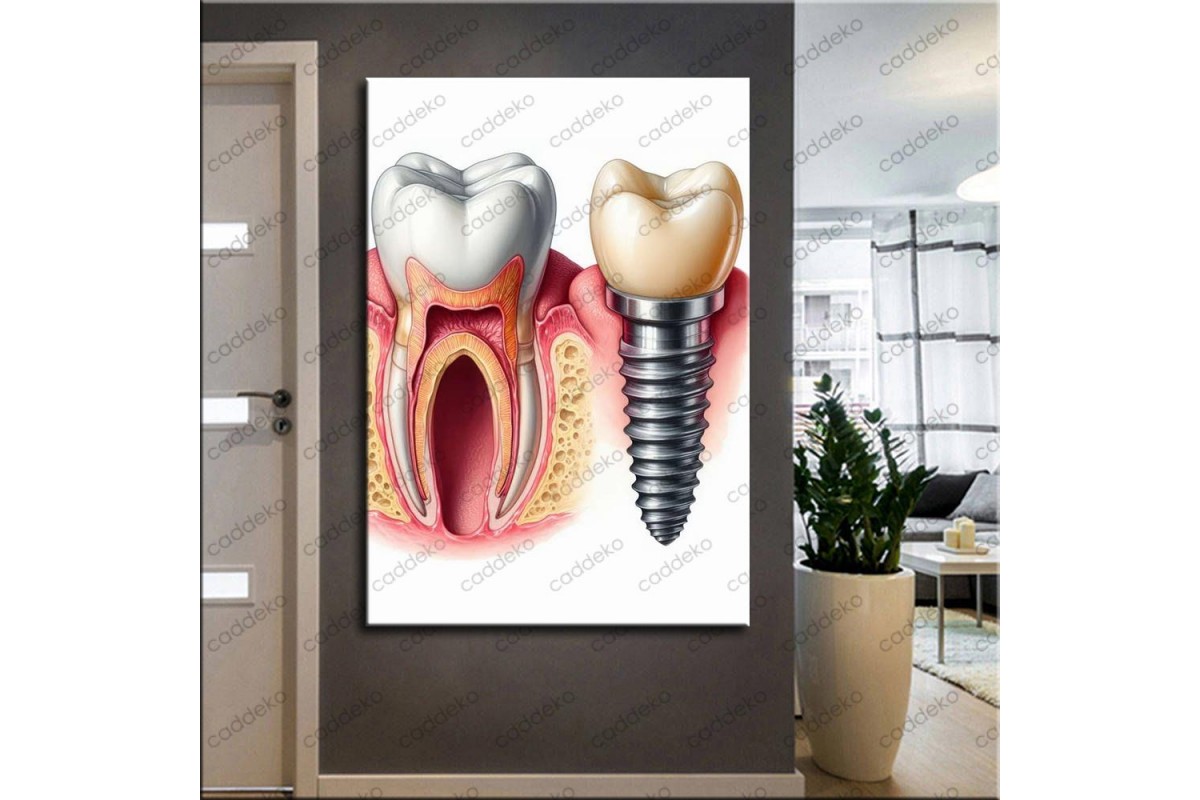 Ağız ve Diş Polikliniği, Dişçi Tabloları Dekoratif Diş, Dekoratif Dişçi, Dişçi Dekorasyonu dsc630