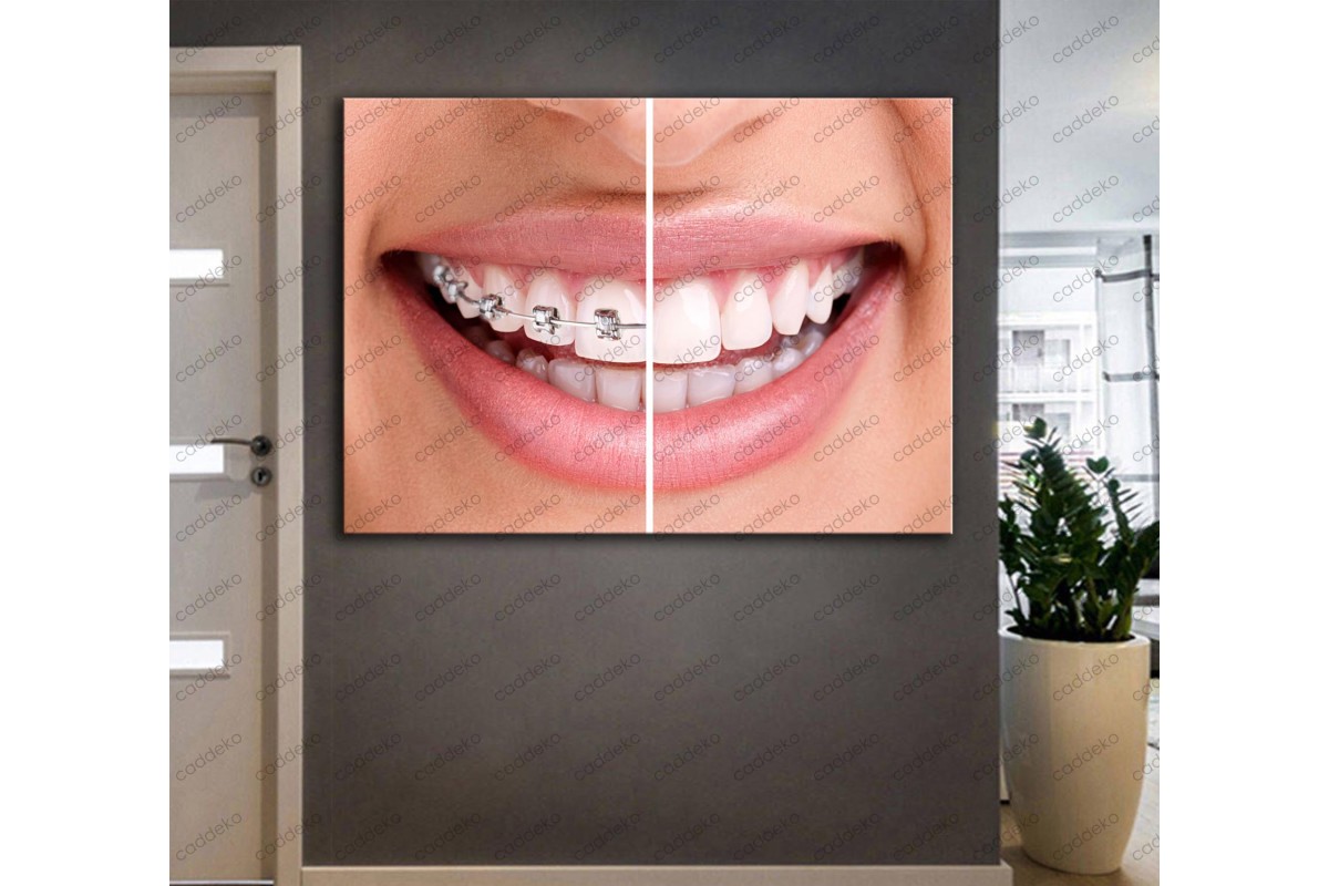 Ağız ve Diş Sağlığı Polikliniği Tabloları Dekoratif Diş, Dekoratif Dişçi, Dişçi Dekorasyonu dsc-09