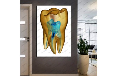 Ağız ve Diş Sağlığı Polikliniği Tabloları Dekoratif Diş, Dekoratif Dişçi, Dişçi Dekorasyonu dsc-133