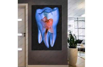 Ağız ve Diş Sağlığı Polikliniği Tabloları Dekoratif Diş, Dekoratif Dişçi, Dişçi Dekorasyonu dsc-135