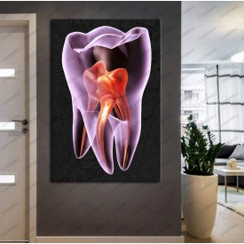 Ağız ve Diş Sağlığı Polikliniği Tabloları Dekoratif Diş, Dekoratif Dişçi, Dişçi Dekorasyonu dsc-140