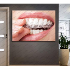 Ağız ve Diş Sağlığı Polikliniği Tabloları Dekoratif Diş, Dekoratif Dişçi, Dişçi Dekorasyonu dsc-155