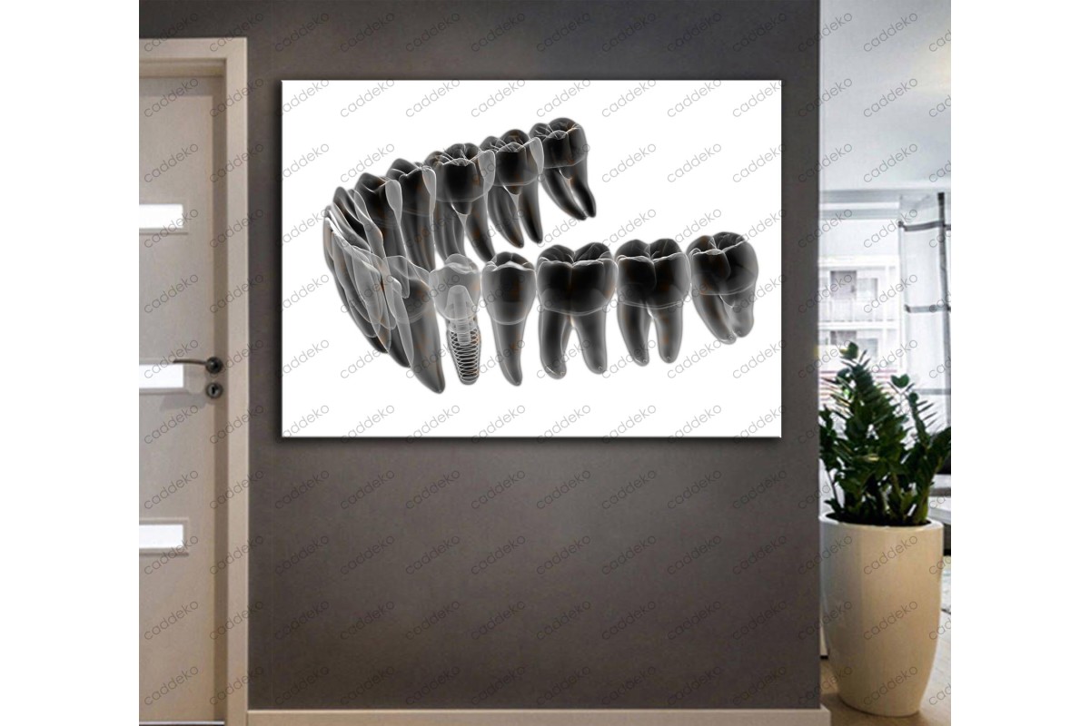 Ağız ve Diş Sağlığı Polikliniği Tabloları Dekoratif Diş, Dekoratif Dişçi, Dişçi Dekorasyonu dsc-159