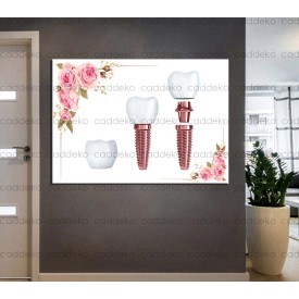 Ağız ve Diş Sağlığı Polikliniği Tabloları Dekoratif Diş, Dekoratif Dişçi, Dişçi Dekorasyonu dsc-168