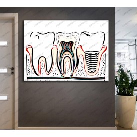 Ağız ve Diş Sağlığı Polikliniği Tabloları Dekoratif Diş, Dekoratif Dişçi, Dişçi Dekorasyonu dsc-27R
