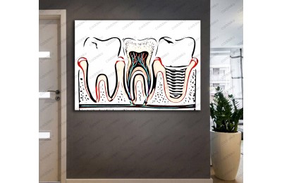 Ağız ve Diş Sağlığı Polikliniği Tabloları Dekoratif Diş, Dekoratif Dişçi, Dişçi Dekorasyonu dsc-27R