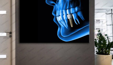 Diş Kliniği Duvar Dekorasyonu: Doğru Tablo Seçimi Rehberi