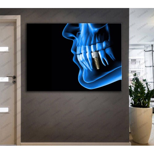 Ağız ve Diş Sağlığı Polikliniği Tabloları Dekoratif Diş, Dekoratif Dişçi, Dişçi Dekorasyonu dsc-28