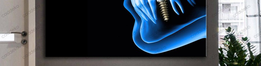 Diş Kliniği Duvar Dekorasyonu: Doğru Tablo Seçimi Rehberi