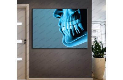 Ağız ve Diş Sağlığı Polikliniği Tabloları Dekoratif Diş, Dekoratif Dişçi, Dişçi Dekorasyonu dsc-28R