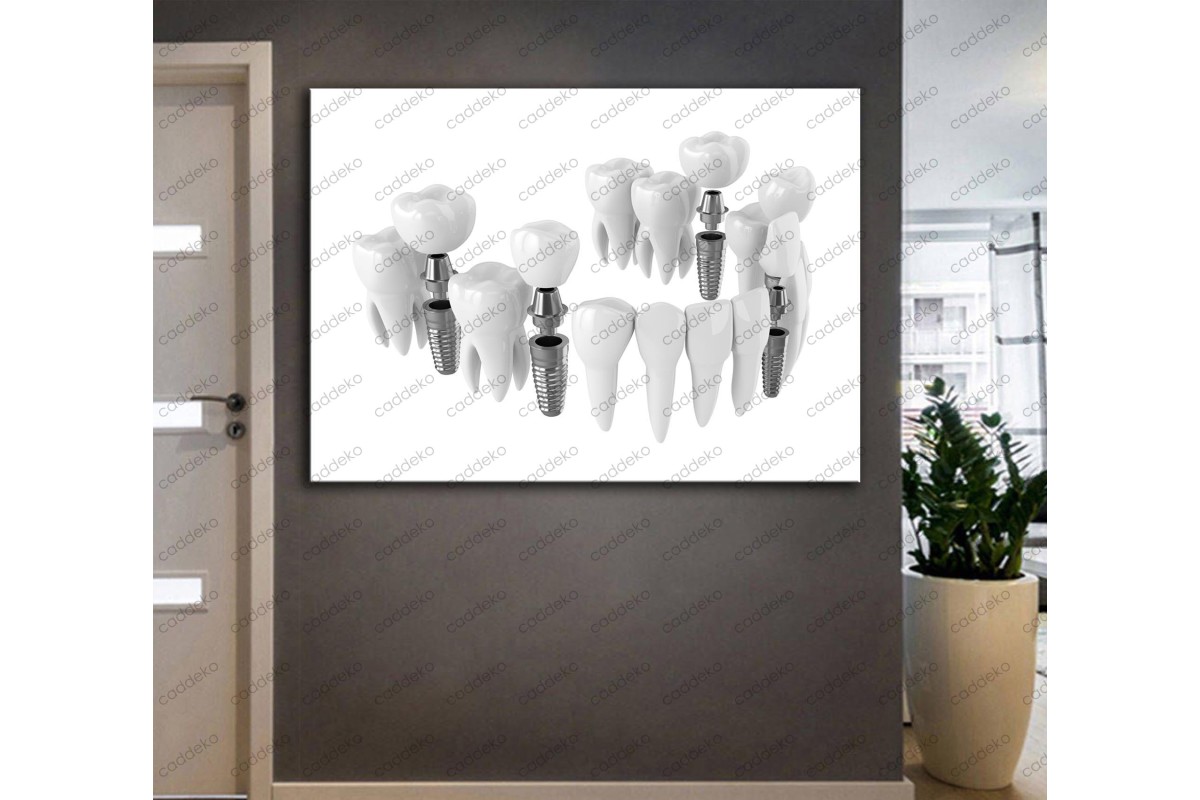 Ağız ve Diş Sağlığı Polikliniği Tabloları Dekoratif Diş, Dekoratif Dişçi, Dişçi Dekorasyonu dsc-31