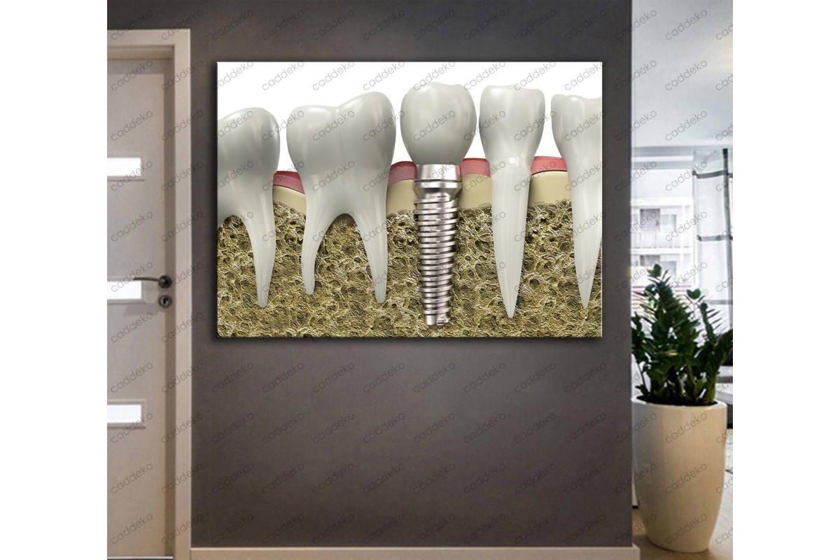 Ağız ve Diş Sağlığı Polikliniği Tabloları Dekoratif Diş, Dekoratif Dişçi, Dişçi Dekorasyonu dsc-32