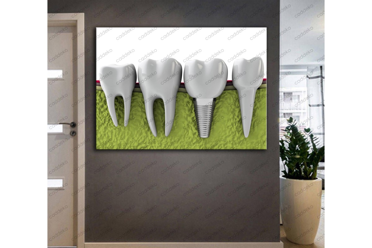 Ağız ve Diş Sağlığı Polikliniği Tabloları Dekoratif Diş, Dekoratif Dişçi, Dişçi Dekorasyonu dsc-33