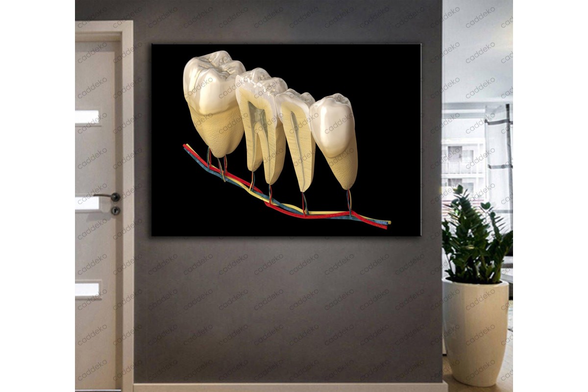 Ağız ve Diş Sağlığı Polikliniği Tabloları Dekoratif Diş, Dekoratif Dişçi, Dişçi Dekorasyonu dsc-34