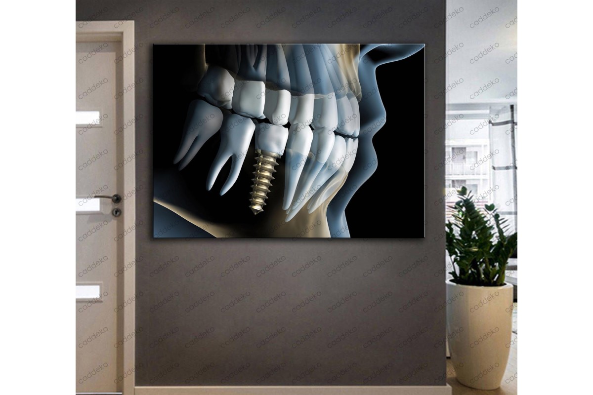 Ağız ve Diş Sağlığı Polikliniği Tabloları Dekoratif Diş, Dekoratif Dişçi, Dişçi Dekorasyonu dsc-35