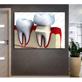 Ağız ve Diş Sağlığı Polikliniği Tabloları Dekoratif Diş, Dekoratif Dişçi, Dişçi Dekorasyonu dsc-39