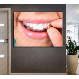 Ağız ve Diş Sağlığı Polikliniği Tabloları Dekoratif Diş, Dekoratif Dişçi, Dişçi Dekorasyonu dsc-46