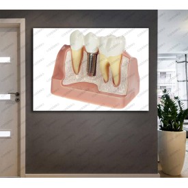 Ağız ve Diş Sağlığı Polikliniği Tabloları Dekoratif Diş, Dekoratif Dişçi, Dişçi Dekorasyonu dsc-61